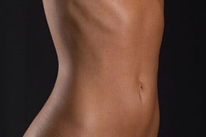 f-liposuction